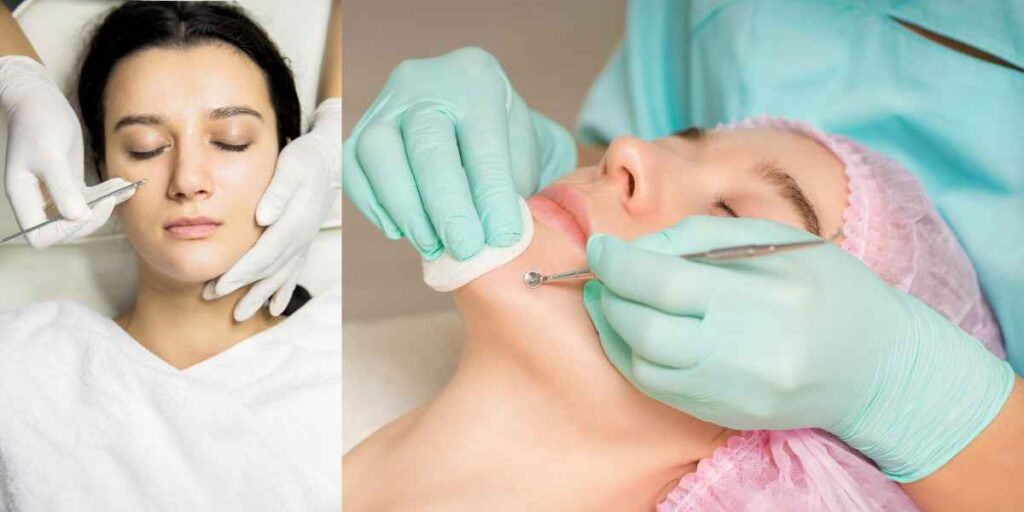 Pore cleansing and extraction