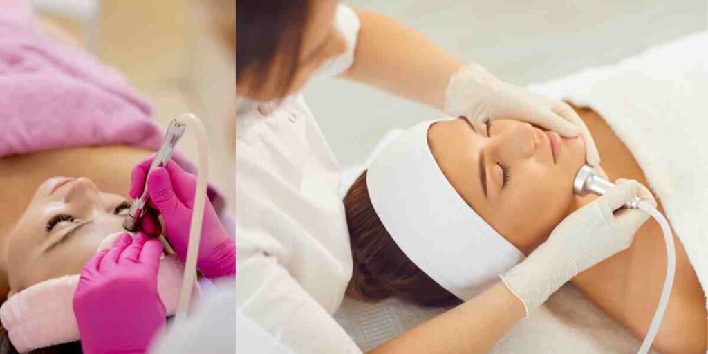 Microdermabrasion