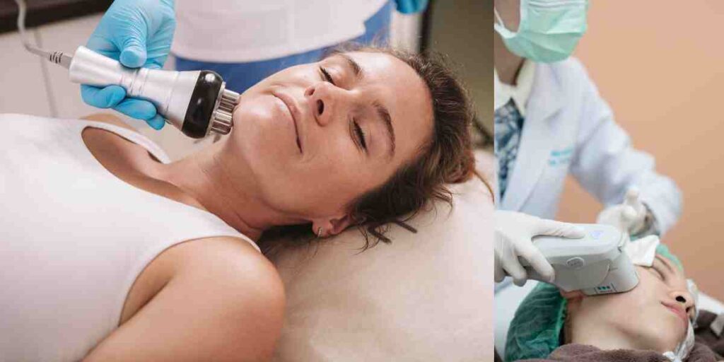 Ultherapy & RF Treatments