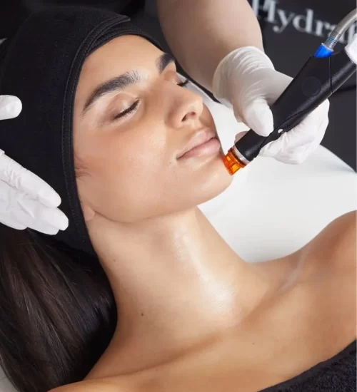 Woman receiving a Hydrafacial treatment with a facial wand applied to her cheek.